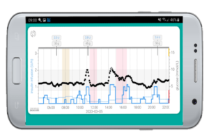 Example of an artificial pancreas system - the CamAPS FX