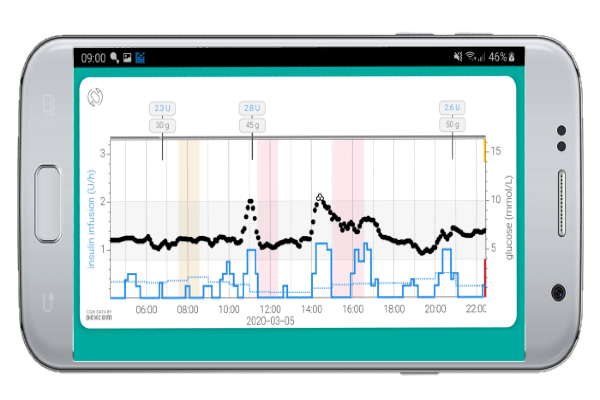 Example of an artificial pancreas system - the CamAPS FX